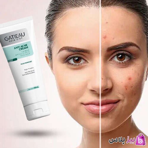 کرم بیوممتیک ژلی آنتی آکنه ضدجوش و ضدلک ۴۰ میل گاتیو ایتالیایی